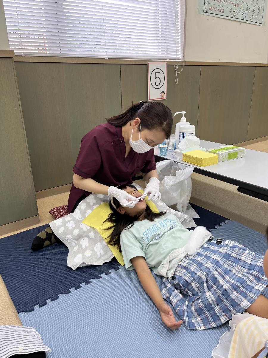 フッ化物塗布の様子